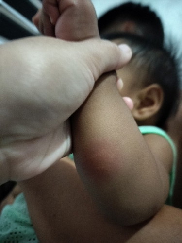 Kagat po ba ito?
Laging may ganito si baby. minsan naagtutubig pa. Ngayon naman parang namaga.