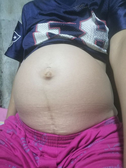 ท้อง 31+²w ท้องเล็กไปไหมค่ะ