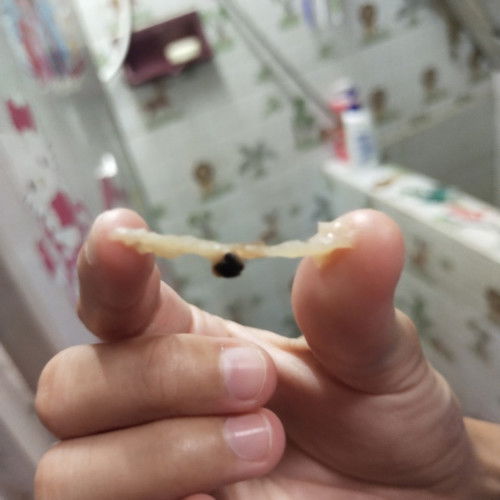 ช่วยดูให้ทีครับแม่ๆ อันตรายไหม  19/2