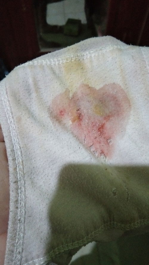 Kehamilan 39 minggu 3 hari