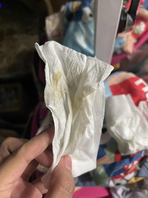 Mucus plug and brown discharge