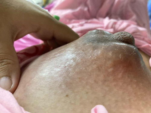 สอบถามแม่ๆบ้านไหนเคยเห็นรึเคยเป็นแบบนี้มั้ยคะ