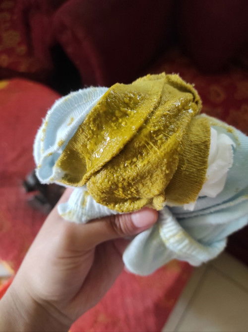 Tanya seputar pup bayi