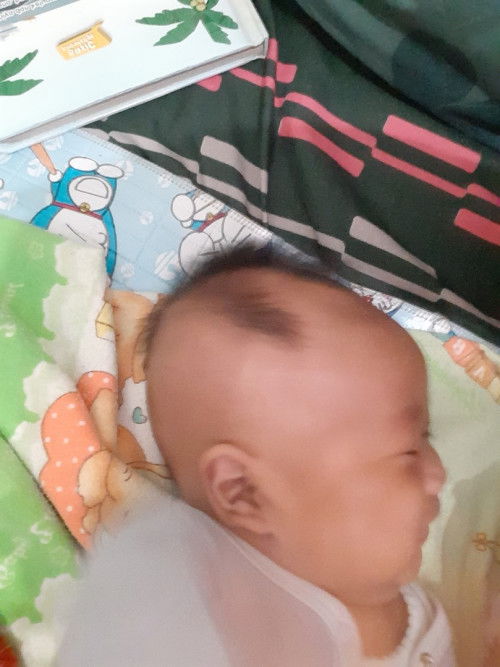 Bayi 2bln 25hari gak mau angkat kepala saat tummy time
