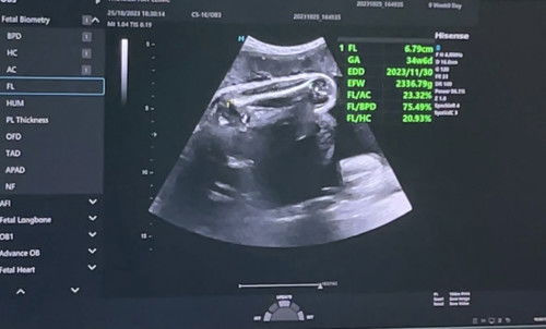 ว่าด้วยเรื่องน้ำหนักเบบี๋