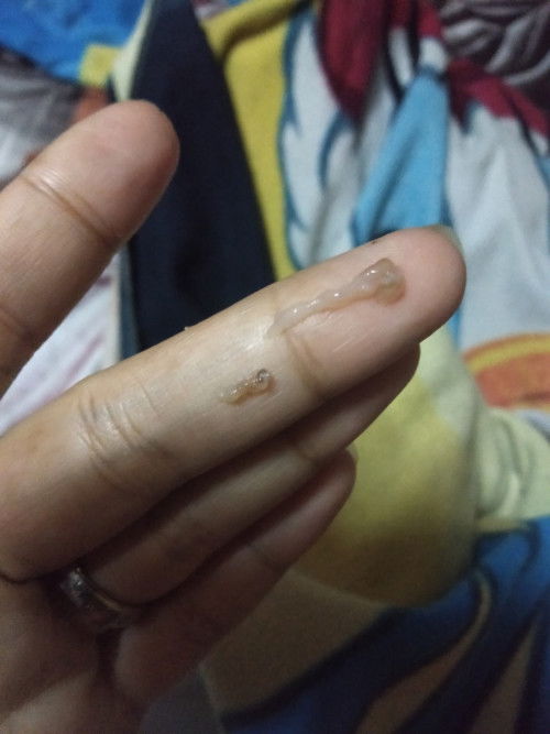 Baka may same case po ako 8 weeks preggy po ako tapos may lumabas po sakin na mucus Ano po kaya ito