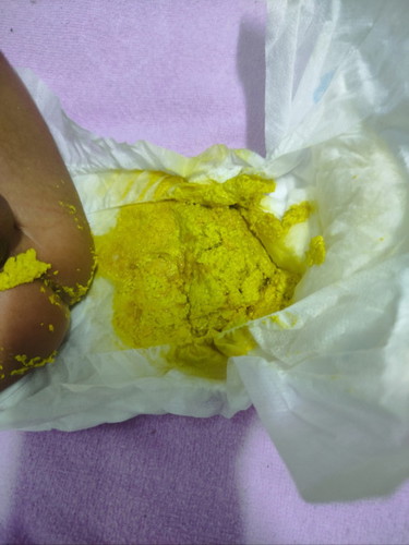 อยากทราบเกี่ยวกับมูก