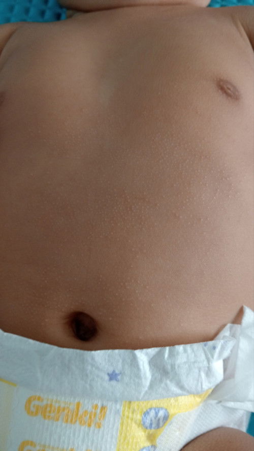 INI RUAM ATAU BUKAN?