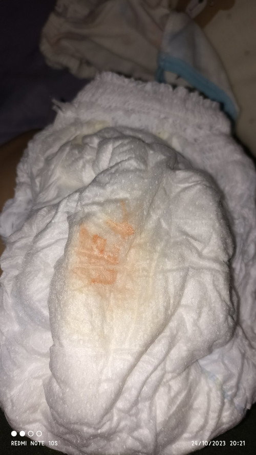 Bayi 6+ BAKnya wrna merah dn orange