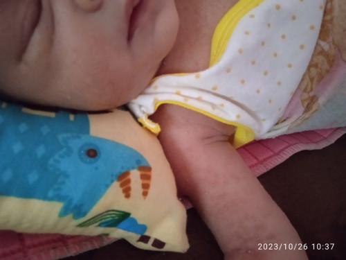 Bun sharing ank sya baru 10 hari trus kluar kyk biang keringat.. kata org sawan kikir jg