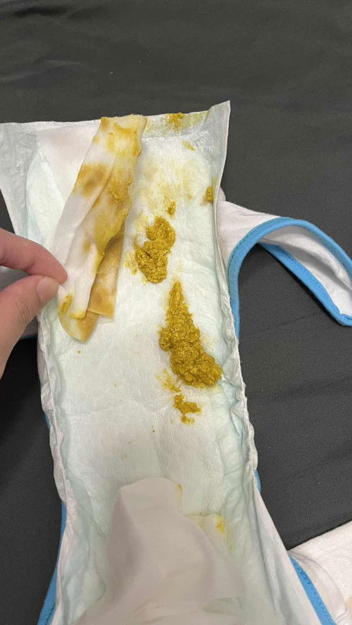 Hơi nhạy cảm một tí , nhưng các mom có kinh nghiệm cho em hỏi