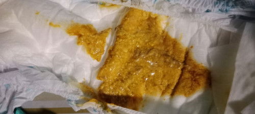 hello po ask kulang po ng tae po kc baby ko sa lactum den pinalitan ko bona nag kalaman dumi nya