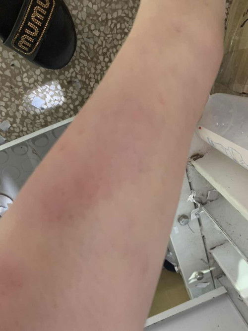 Giúp em với mn ơi