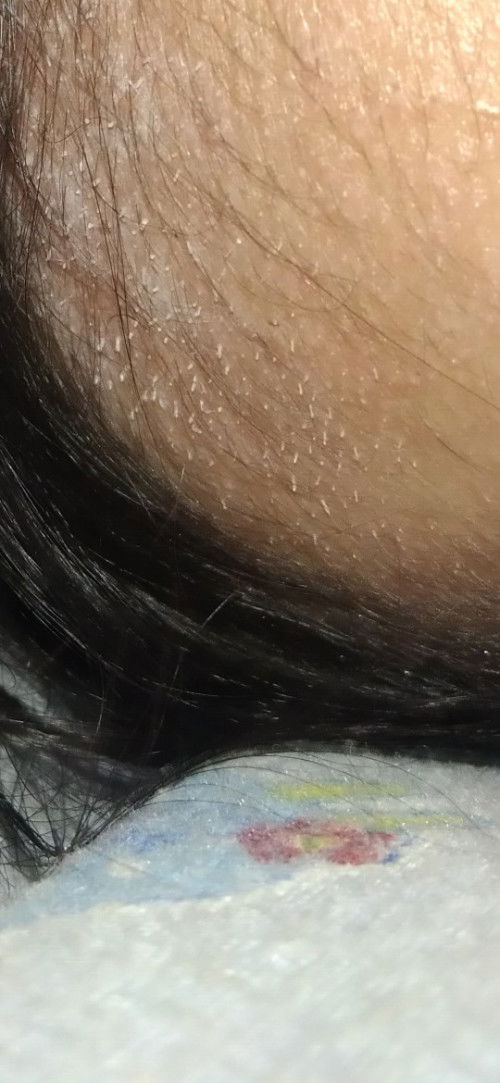 Biang keringat saat udara panas seperti sekarang