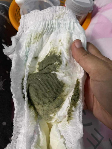 น้องอึแบบนี้ปกติมั้ย
