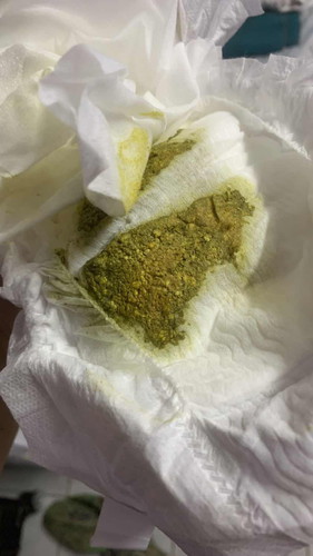 Najis kuning kehijauan