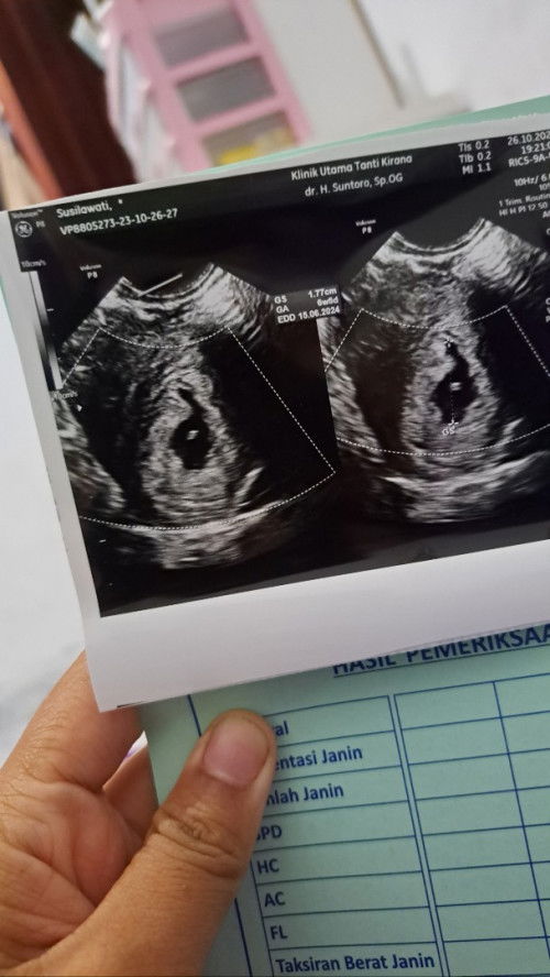 Bayi tidak berkembang