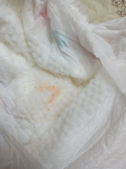 Boleh tahu adakah normal terdPt spot mcm darah di pampers baby.bby 6bln.byk kali juga j lod mcm tu.