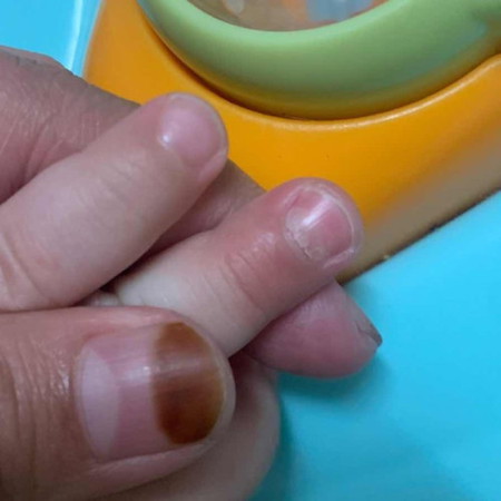 Kuku bayi macam rosak