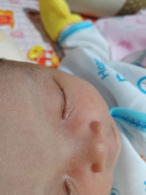 Bintik pada bagian kepala dan wajah