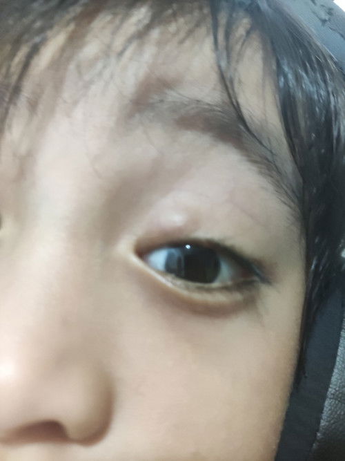 Mga Mi ano kaya ito ?