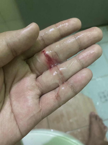 36week4hari keluar lendir campur darah sikit