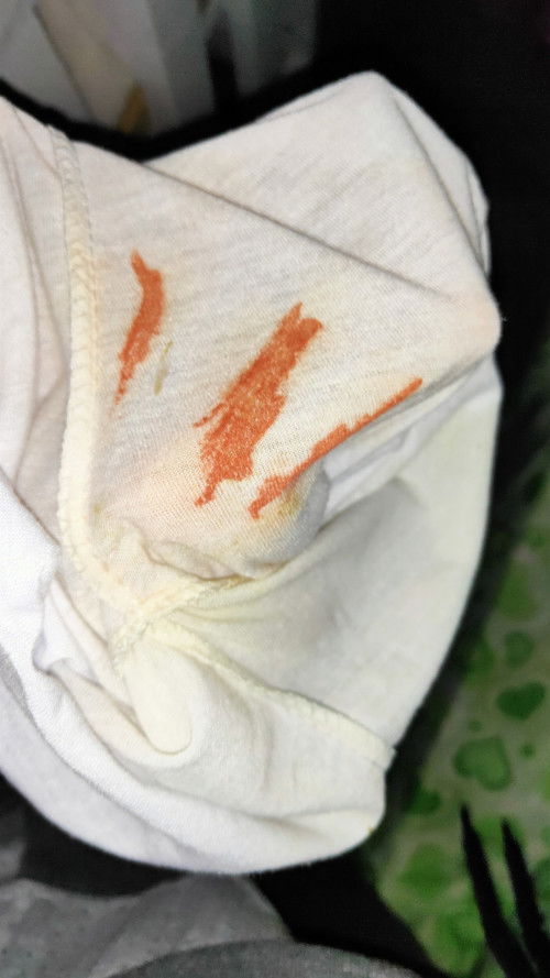 Pinky red sa ihi ng baby