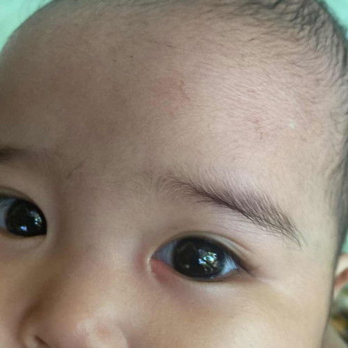 Mata bayi 4 bulan merah diujung