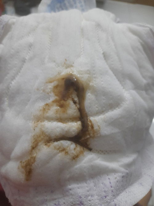 37 minggu keluar lendir putih dengan coklat