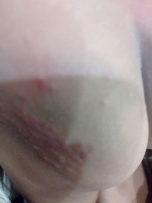 Bintik kecil dan merah