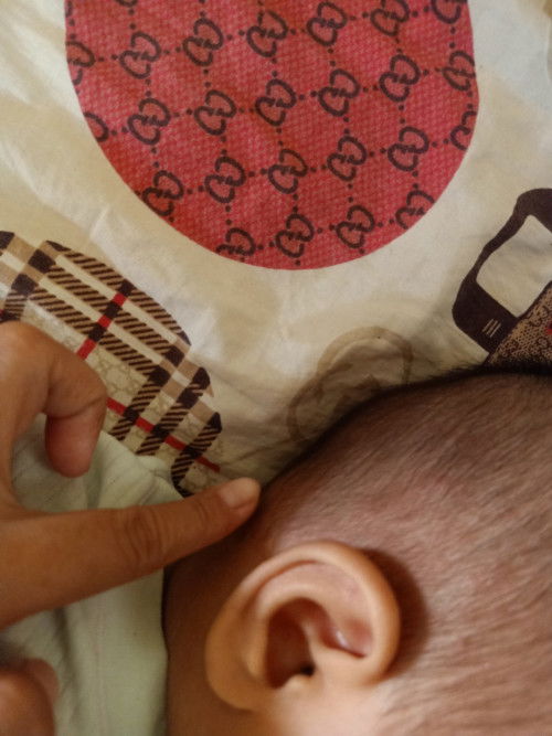 Ada semacam benjolan