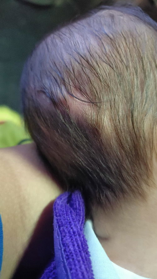 หัวลูกเป็นแบบนี้ปกติมั้ยคะ