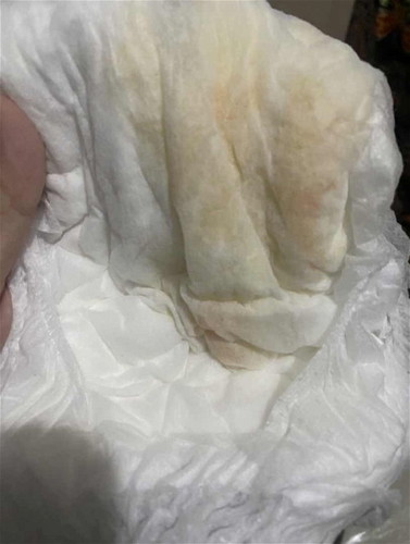 Pipis bayi keruh, ada warna orange