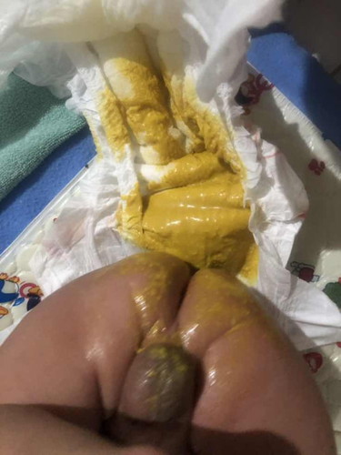 ลูกถ่ายแบบนี้ปกติไหมคะ