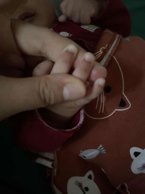 Ujung jari hitam pada bayi newborn