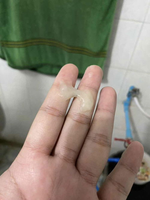 ตั้งครรภ์ 38+3 มีมูกออกมา