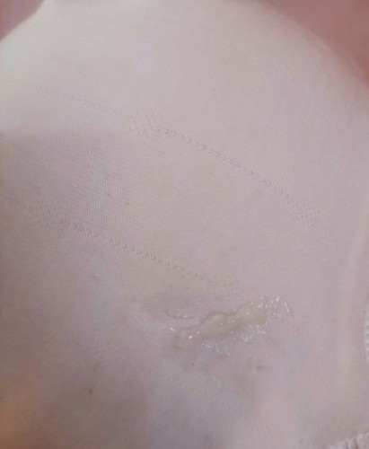 35 weeks Discharges na parang sipon