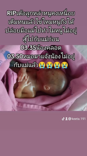 บ้านหลังนี้น้องคลอดก่อนกำหนด 5 เดือนกับอีก 6 วันตอนนี้ยังทำใจไม่ได้เลยค่ะน้องพึ่งจากคุณแม่ไปเมื่อวาน