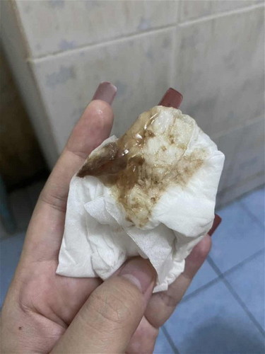 มีมูกสีน้ำตาล 40week