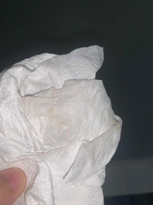 Mintak tlong tgkkan siapa ada pengalaman, lendir mucus 36w 3d