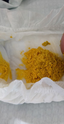 Newborn baby poop