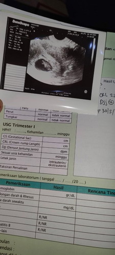 Hallo bunda, sy hamil di usia 9minggu blm terdengar detak jantung, apakah normal 🙏