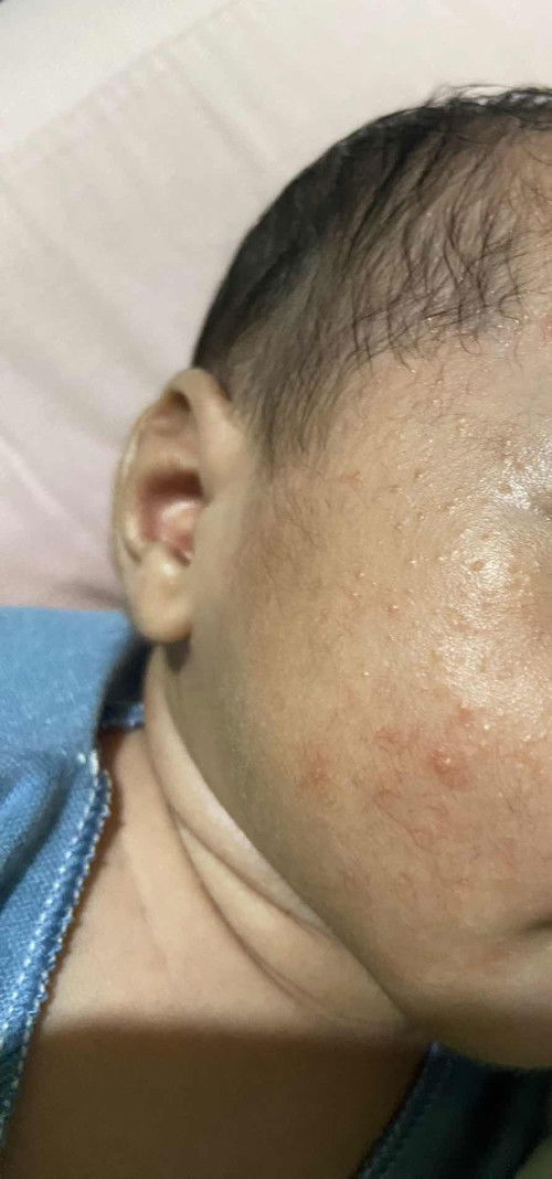 Rekomendasi untuk bayi