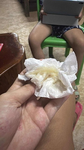 มูกแบบนี้ 38+5w อีกนานไหมคะจะคบอด