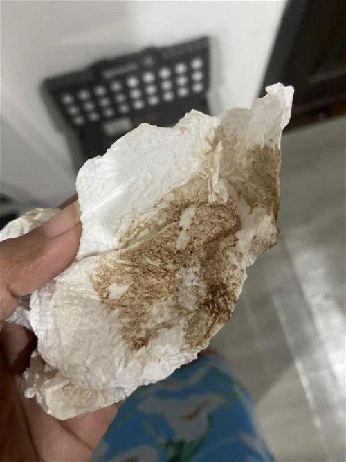 ท้อง5วีค มีตกขาวสีน้ำตาลเข้มไหลออกมา