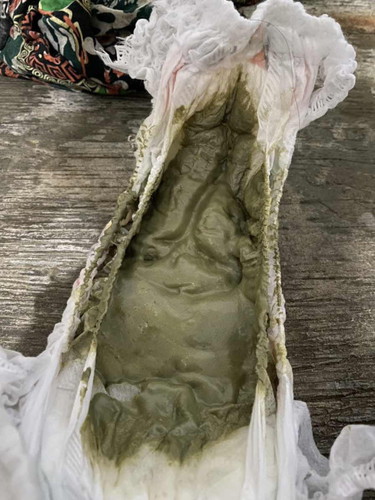 bun pup kaya gini kenapa ya? bayiku mix asi sufor tp banyakan sufor..