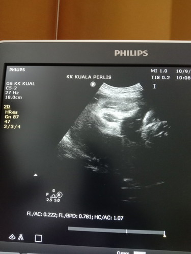 Boy or girl