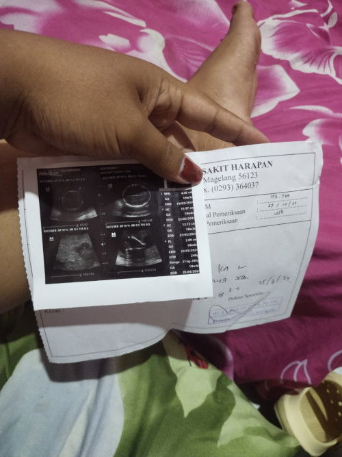 Bubid mau tanya saya habis Hb SMA suami tba2 dedeknya kok gak gerak kenapa ya ..18weekk#bantusharing