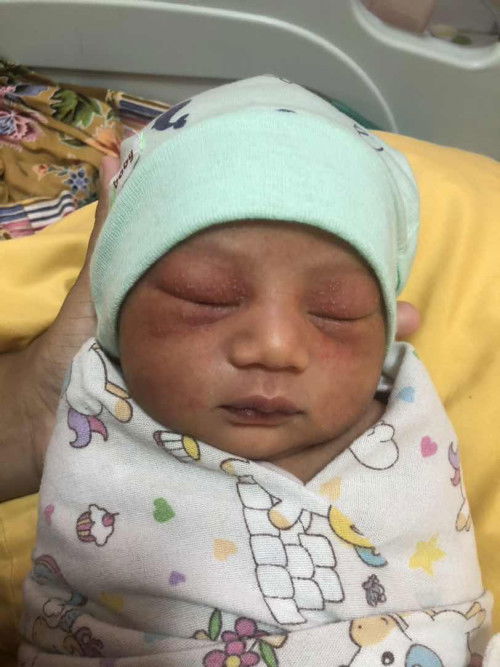 Perintisan pada New born