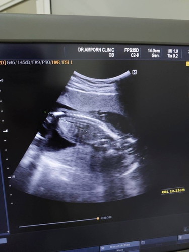 เวลาซาวด์
แม่ๆคนไหนเคยเจอลูกอยู่ท่านี้บ้างคะ